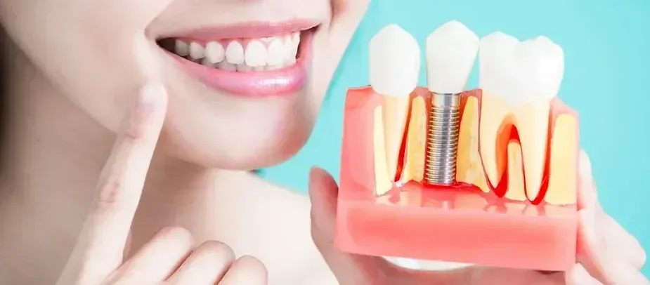 Dental Implants: A Permanent Solution