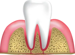 Healthy gums and tooth